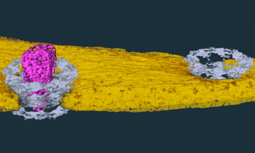 Imagem mostra cápsula da proteína do HIV (rosa) passa intacta por um poro (cinza) na membrana celular (amarelo), onde se desintegra e libera seu material genético.  (Foto: Cell)