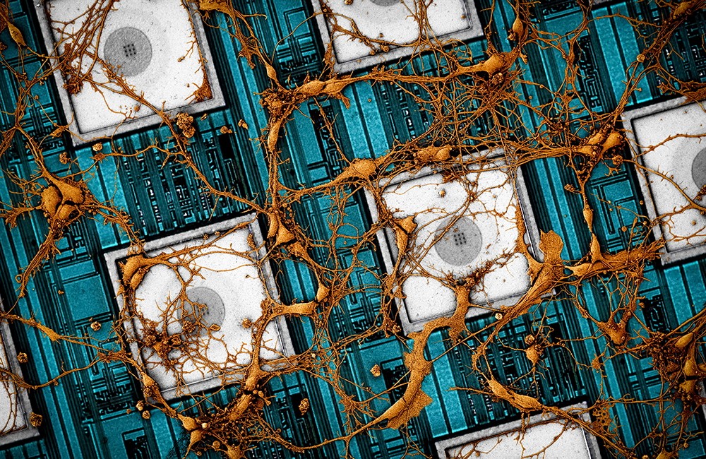 Imagens de neurônios de rato na matriz de nanoeletrodos  (Foto: Reprodução/Samsung)