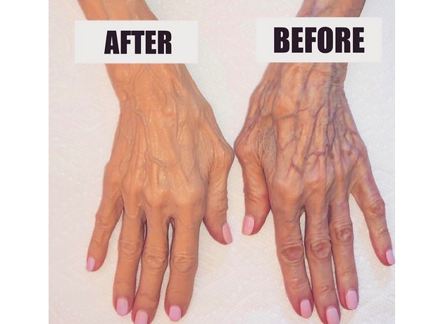 A foto compartilhada por Kim Kardashian mostrando as mãos da avó antes e depois da aplicação de uma maquiagem (Foto: Instagram)