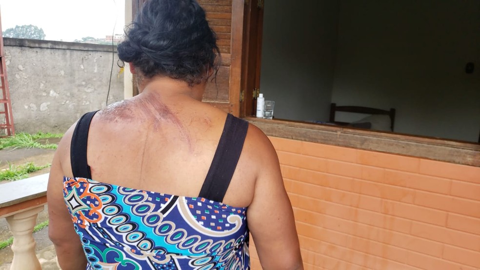 Ao pular de ônibus em João Monlevade, Solange machucou as costas — Foto: Vladimir Vilaça/TV Globo 