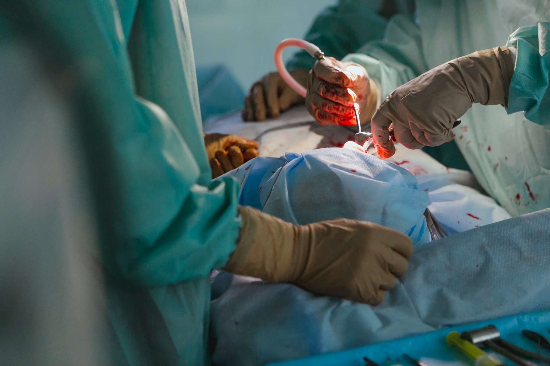 Teste de transplante renal de porco para humano tem sucesso nos EUA (Foto: Olga Kononenko/Unsplash)
