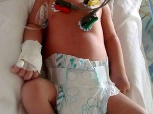 Bebê Augusto Siqueira precisa fazer com urgência cirurgia no coração (Foto: Elzângela Siqueira / Arquivo Pessoal)