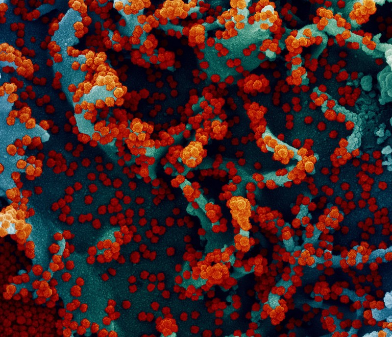 Micrografia eletrônica de varredura colorida de uma célula fortemente infectada com partículas do vírus Sars-CoV-2 (vermelho), isolada de uma amostra de paciente (Foto: NIAD )
