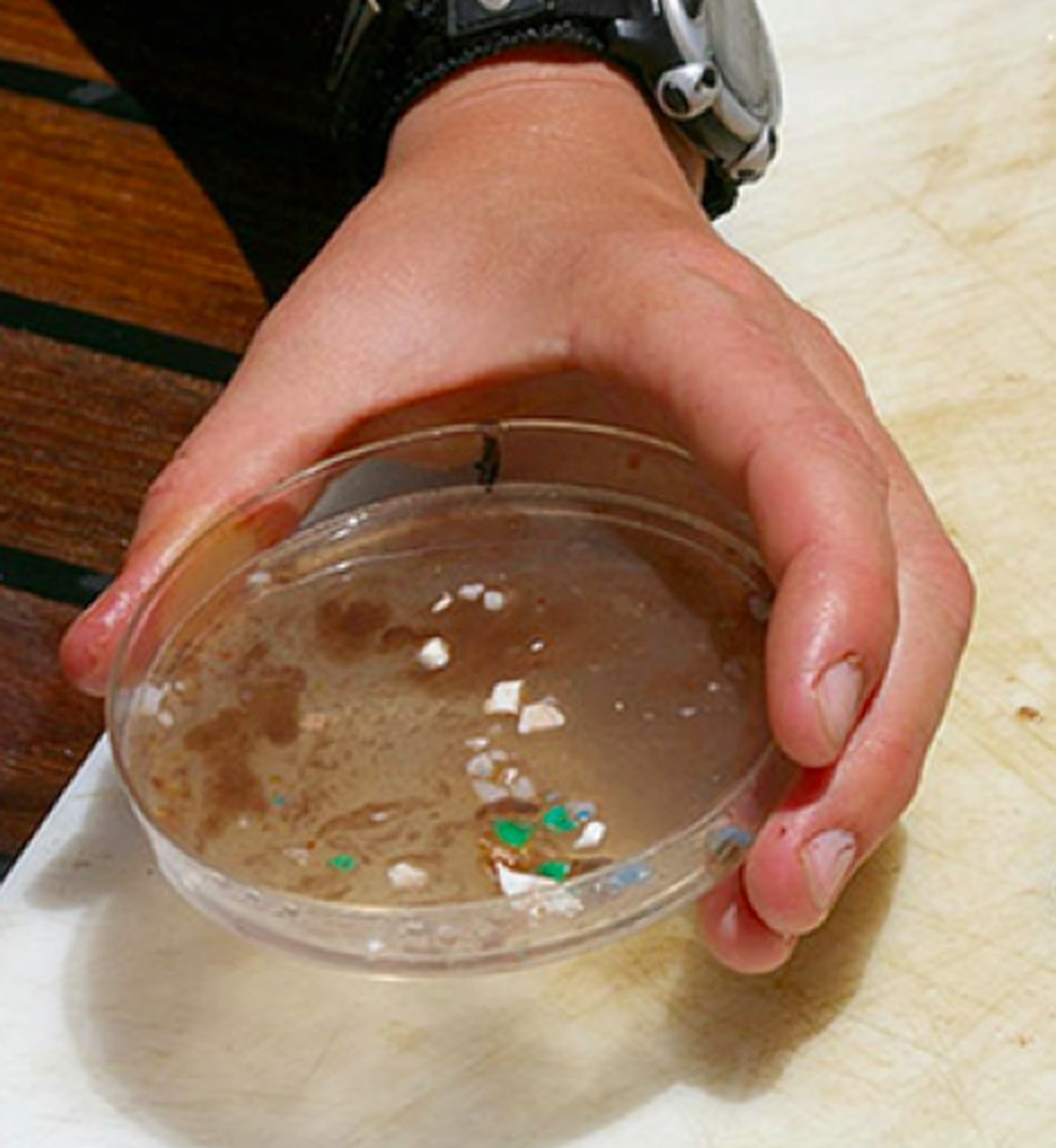 'Nossa principal preocupação é, especialmente, o que pode significar para pacientes com doenças gastrointestinais', diz médico que conduziu estudo — Foto: Medical University of Vienna/Divulgação