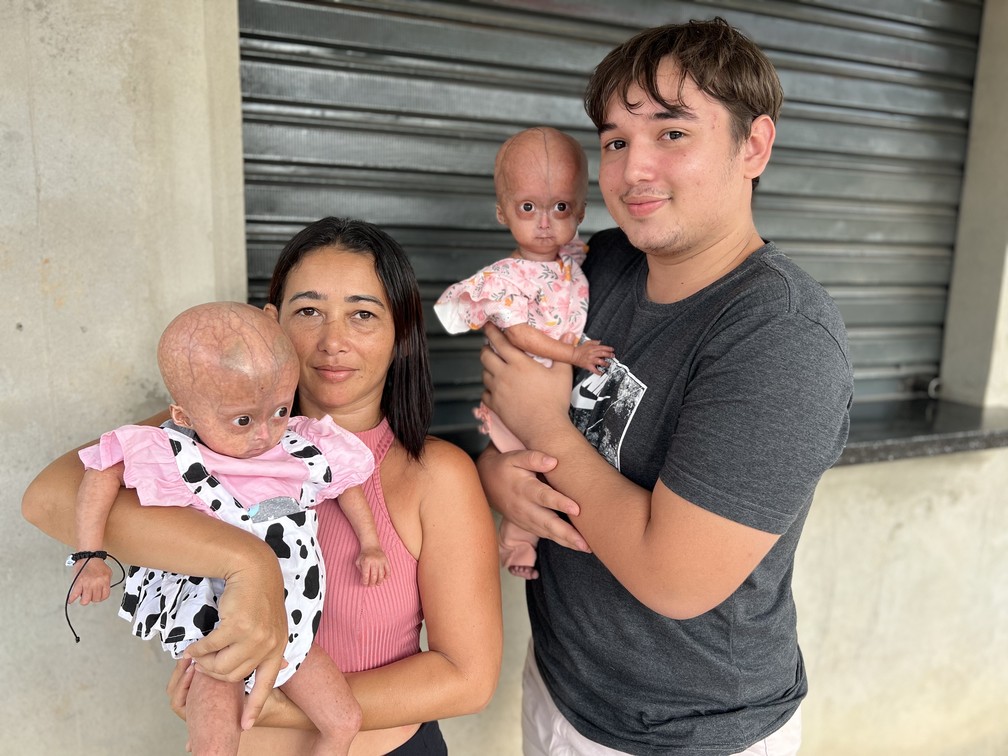 Eliz e Eloá vivem com a mãe, o irmão e a irmã adolescente na zona Oeste de Boa Vista — Foto: Caíque Rodrigues/g1 RR
