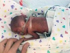 Bebê que nasceu com 680 g durante cruzeiro vai para casa nos EUA
