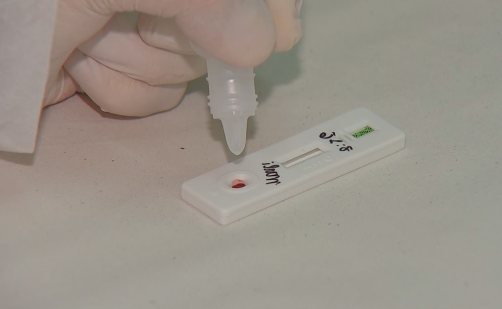 Bertioga Inicia Testagem Para Deteccao E Mapeamento De Variantes Da Covid 19 Mais Saude G1
