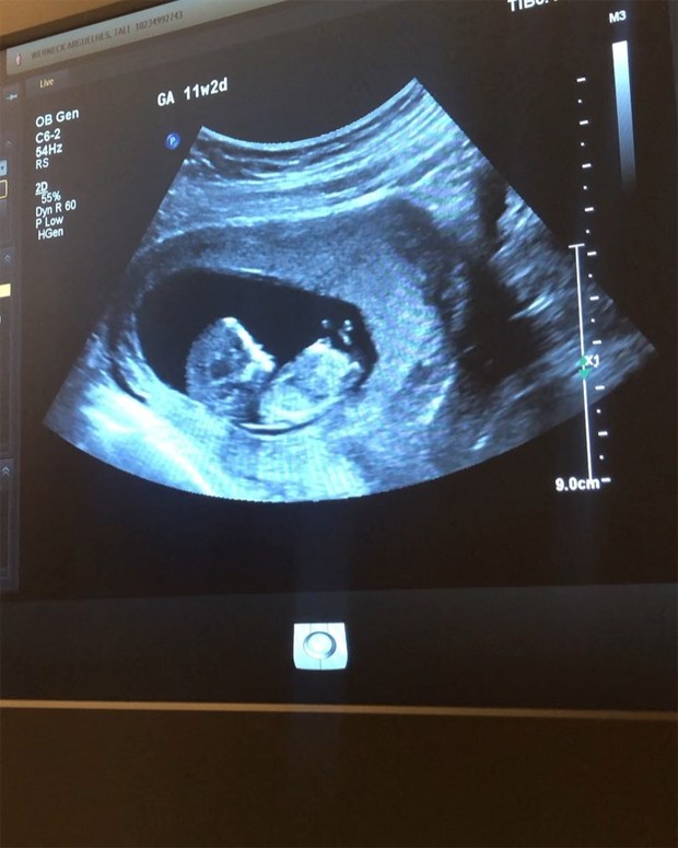 Tata Werneck mostra a ultrassom da filha (Foto: Reprodução / Instagram)