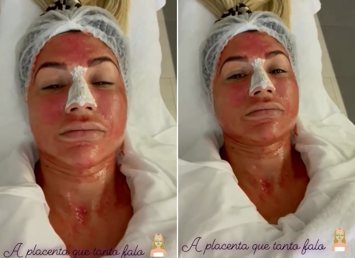 Dani Souza mostra tratamento facial feito com placenta - Quem | QUEM News