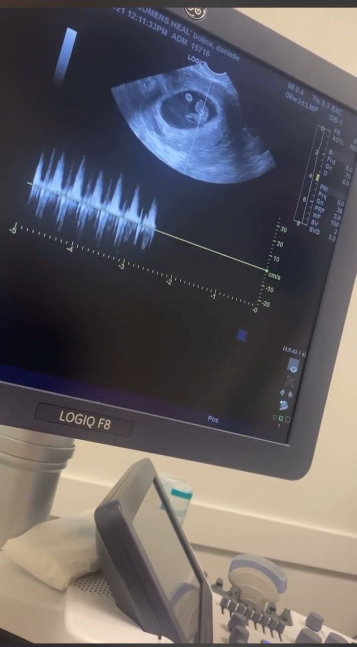 Dani Bolina mostra ultrassom da gravidez (Foto: Reprodução/Instagram)
