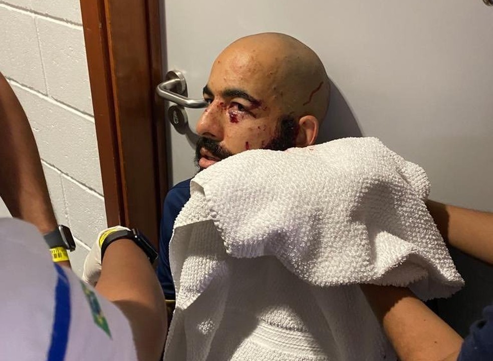 Danilo Fernandes foi atingido por estilhaços — Foto: Reprodução/Redes Sociais