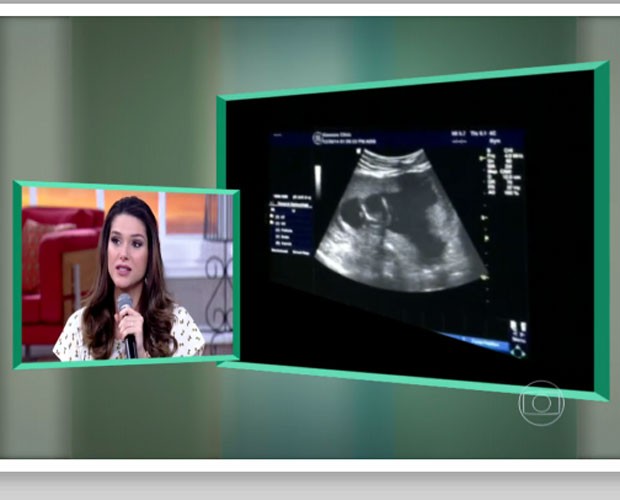 Fernanda Machado mostra ultrassonografia de Sophia (Foto: Gshow/Encontro com Fátima)