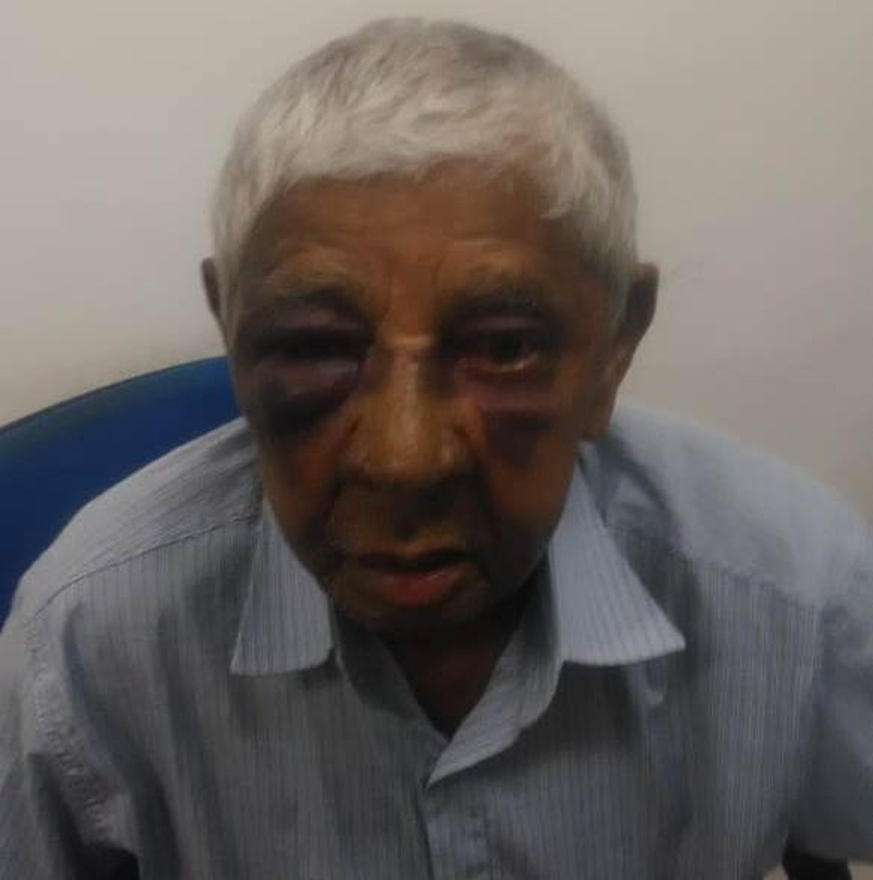 Antônio Francisco da Silva, de 86 anos, sofreu uma fratura na mandíbula e escoriações no rosto após assalto em Teresina — Foto: Divulgação