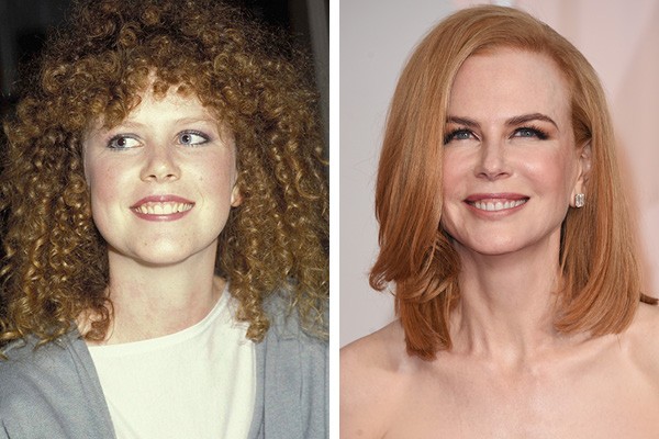 Nicole Kidman em 1986 e em 2015 (Foto: Getty Images)