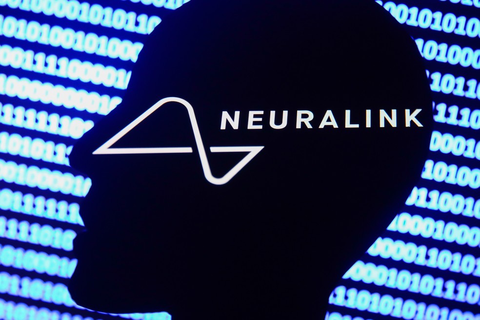 Neuralink: chip será testado em humanos — Foto: Getty Images/Jakub Porzycki/NurPhoto