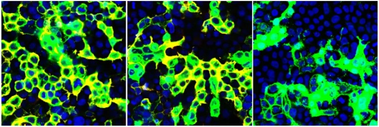 Cientistas encontram anticorpo que bloqueia infecção de Sars-CoV-2 nas células. Acima: os receptores do anticorpo em culturas celulares de Sars-CoV, Sars-CoV-2 e Mers (Foto: Nature Communications)