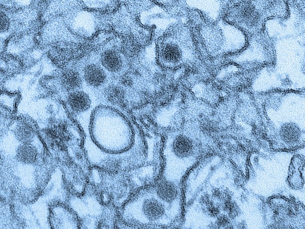 O vírus da zika (pontos pretos) em tecido humano numa imagem de microscópio eletrônico (Foto: Cynthia Goldsmith/CDC)
