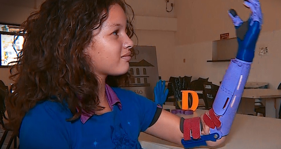 Menina venezuelana ganha próteses de mãos e antebraços feitas em impressora 3D em SP