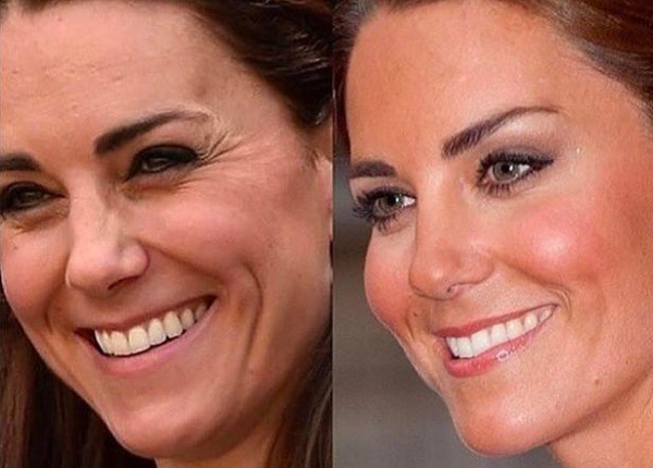 Fotos de Kate Middleton usadas por clínica de cirurgia plástica (Foto: Instagram)