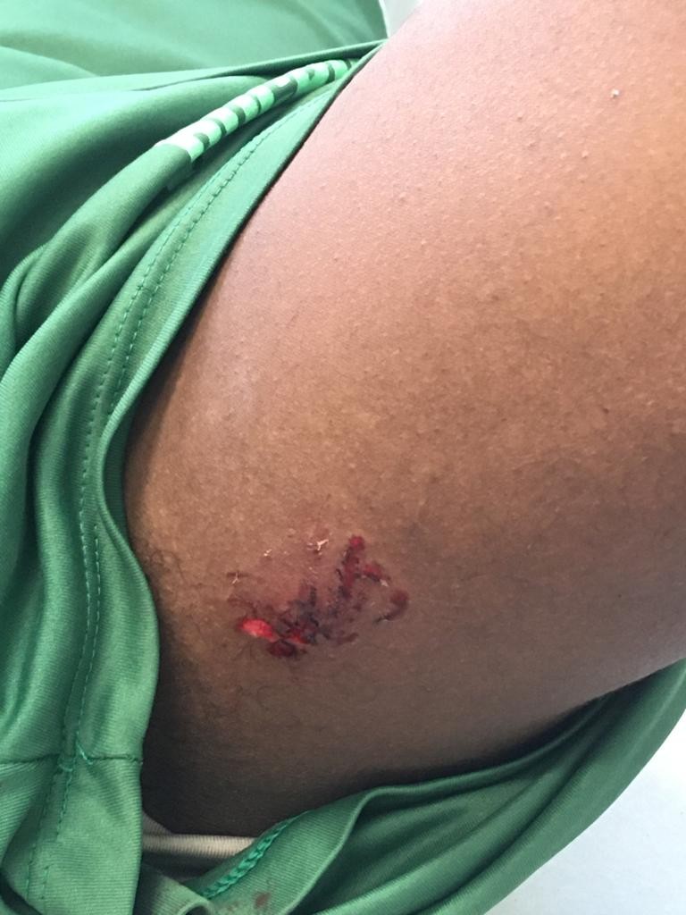 Jogadores da escolinha do Guarani ficam feridos por ataque de filhotes de pitbull no CT do clube