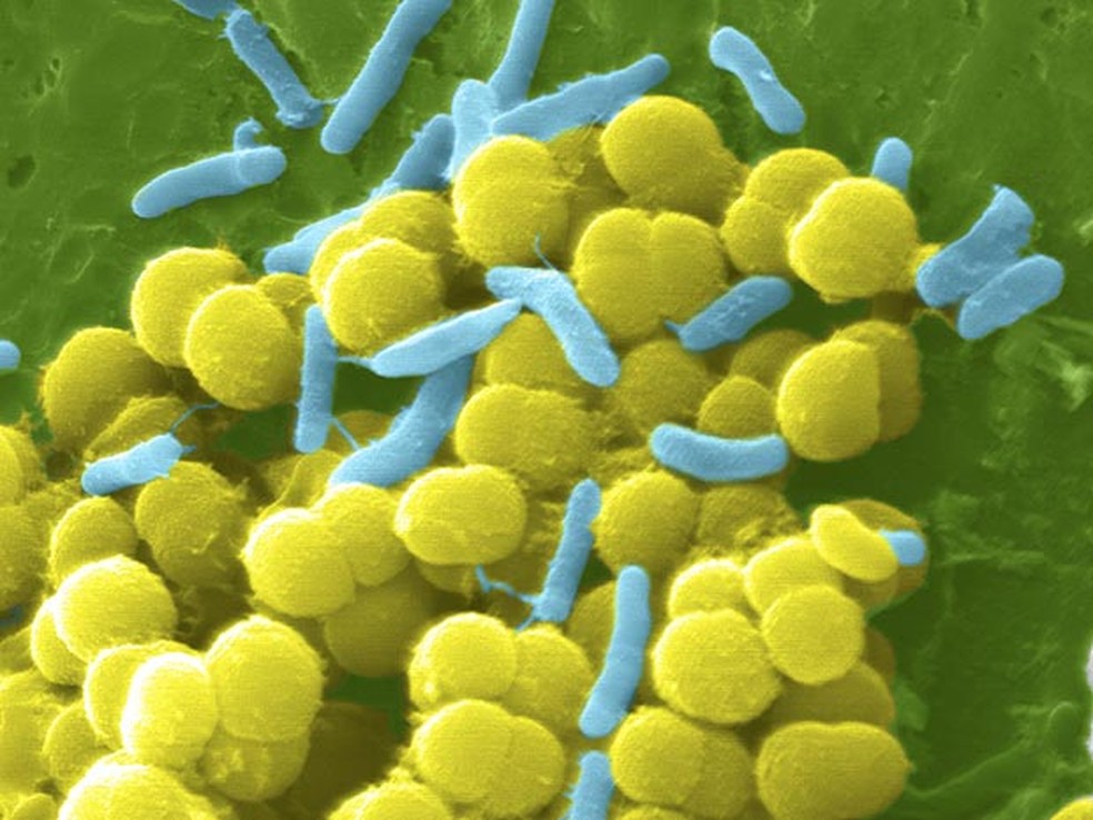 Grupo de `Staphylococcus aureus` é vista por microscopia eletrônica. — Foto: Institutos de Saúde dos EUA