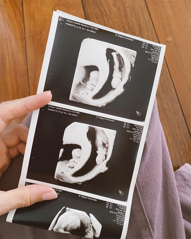 Isa Scherer está grávida de gêmeos (Foto: Reprodução / Instagram)