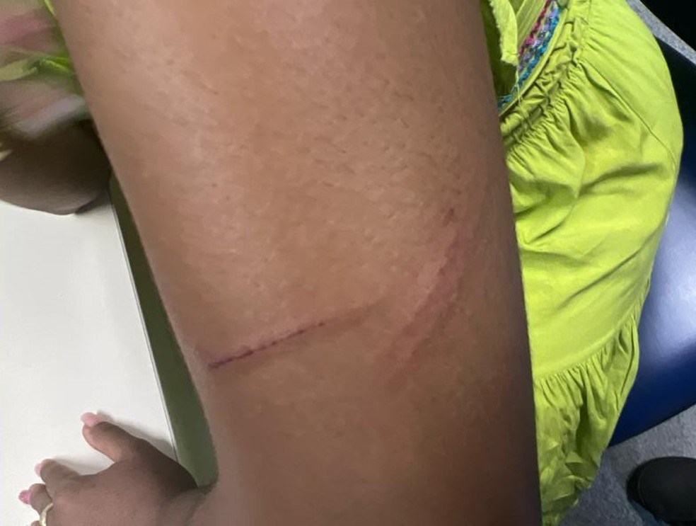 Cantora gospel relata ter sido agredida por motorista de transporte por aplicativo na Bahia — Foto: Reprodução/Redes Sociais