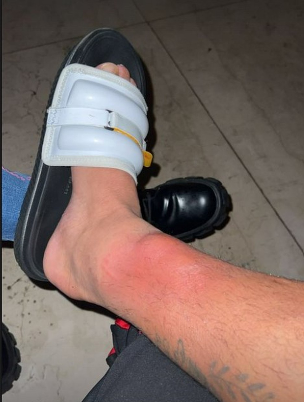 Vidal mostra o estado de sua perna ap&oacute;s o Flamengo x Corinthians &mdash; Foto: Reprodu&ccedil;&atilde;o