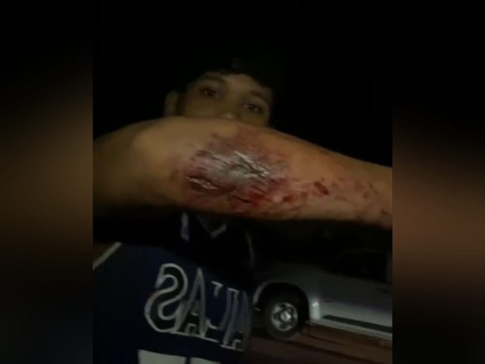 João Pedro Sousa Medeiros, 21 anos, ficou com o braço ferido após o ônibus de viagem que ele estava tombar no quilômetro 358, da BR-020, em Maranguape. — Foto: Reprodução