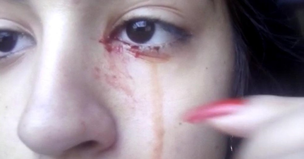 Adolescente começou a chorar sangue em Adolfo — Foto: Arquivo Pessoal 