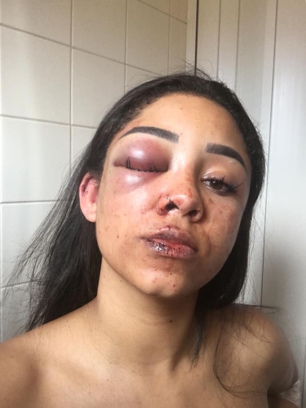 Mariana foi agredida com socos na cabeça e no rosto — Foto: Arquivo Pessoal