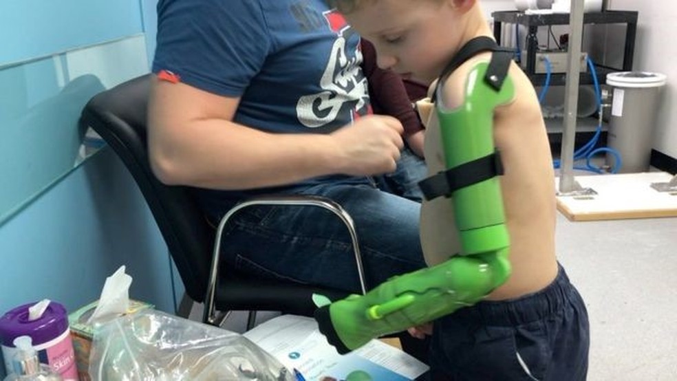 Jacob agora é capaz de segurar objetos com sua prótese funcional — Foto: BEN RYAN