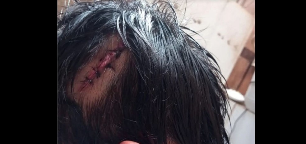 Indígena é atacado com golpes de remo na cabeça em Rondônia. — Foto: Divulgação