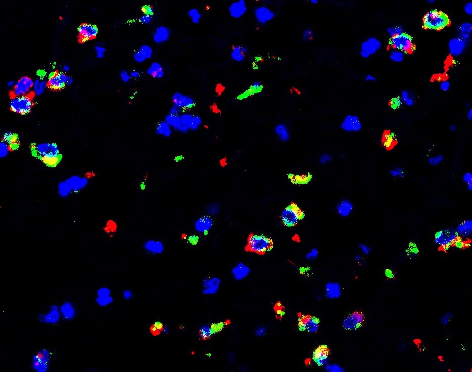 O vírus ebola (em vermelho) persiste especificamente nos macrófagos (verde) que se infiltram no sistema ventricular cerebral de um macaco rhesus que sobreviveu à exposição ao vírus após tratamento com anticorpos monoclonais (azul) (Foto:  Xiankun (Kevin) Zeng, USAMRIID)