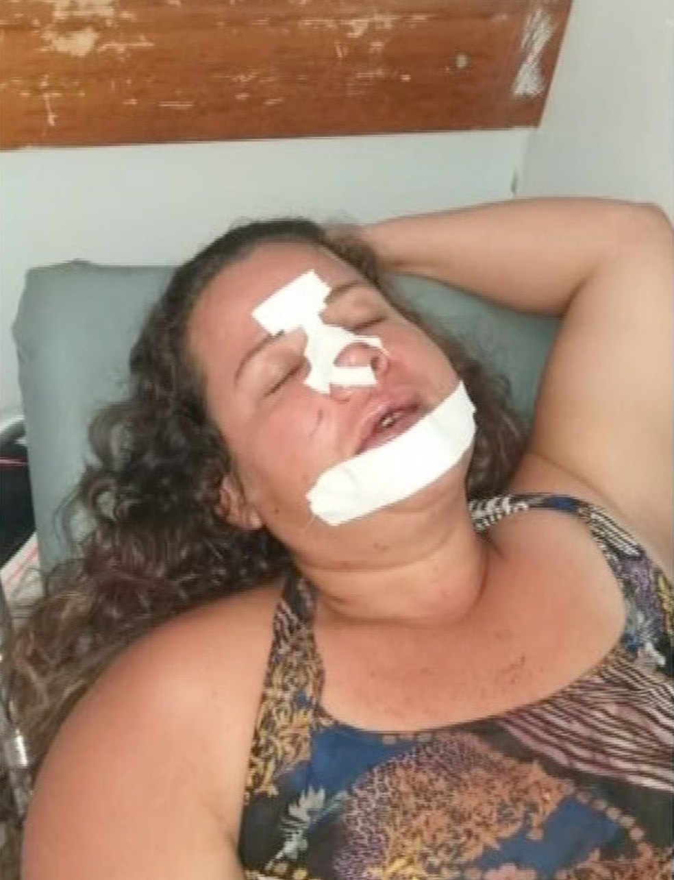 Vítima ficou internada no pronto-socorro e recebeu alta nessa segunda-feira (20) — Foto: TVCA/Reprodução