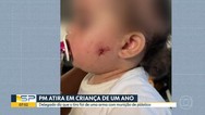 Foto: Vídeo: PM atira em rosto de menina de 1 ano com arma de airsoft na Zona Leste de SP