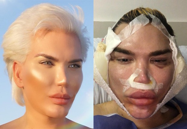 Rodrigo Alves, o Ken Humano, revela tomar leite de barata