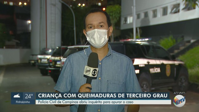 Polícia de Campinas abre inquérito para investigar caso de maus-tratos contra criança