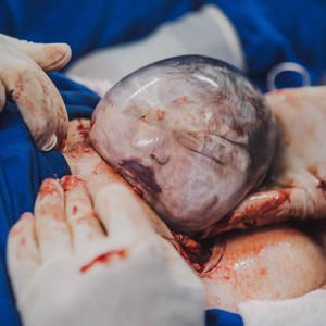 Foto emocionante: bebê segura na mão da obstetra antes mesmo de nascer -  Revista Crescer