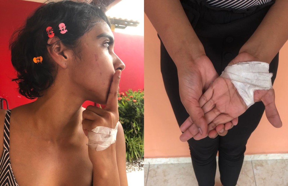 Universitária é agredida por grupo de vizinhos em Manaus após ouvir comentários racistas. — Foto: Rebeca Beatriz/G1 AM