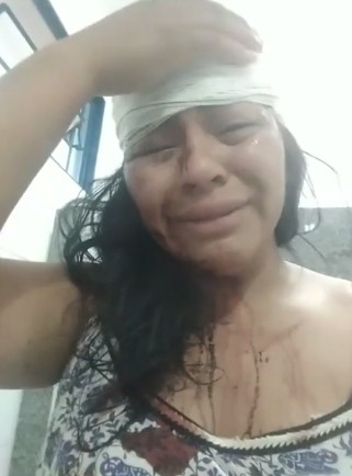 Aline de Souza da Silva denuncia agressão (Foto: Reprodução / Instagram)