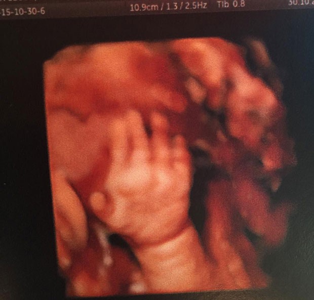 Deborah Secco mostra mãozinha de Maria Flor em ultrassom (Foto: Reprodução/Instagram)