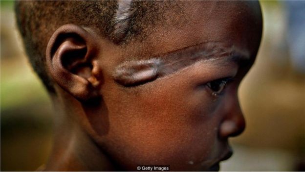 Armas são dificilmente um pré-requisito para a violência - como o genocídio em Ruanda (Foto: GETTY IMAGES via BBC)