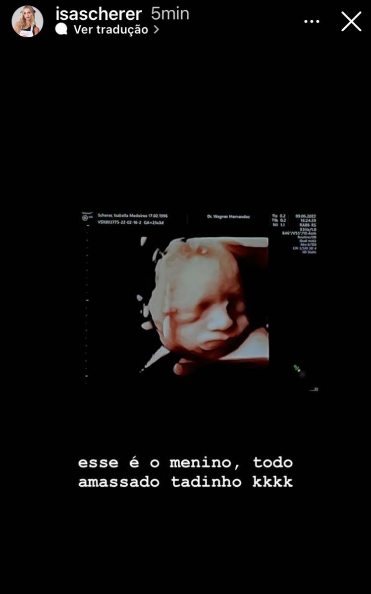 Isa Scherer mostra ultrassom dos gêmeos e brinca: 'O menino todo amassadinho' (Foto: Reprodução / Instagram)