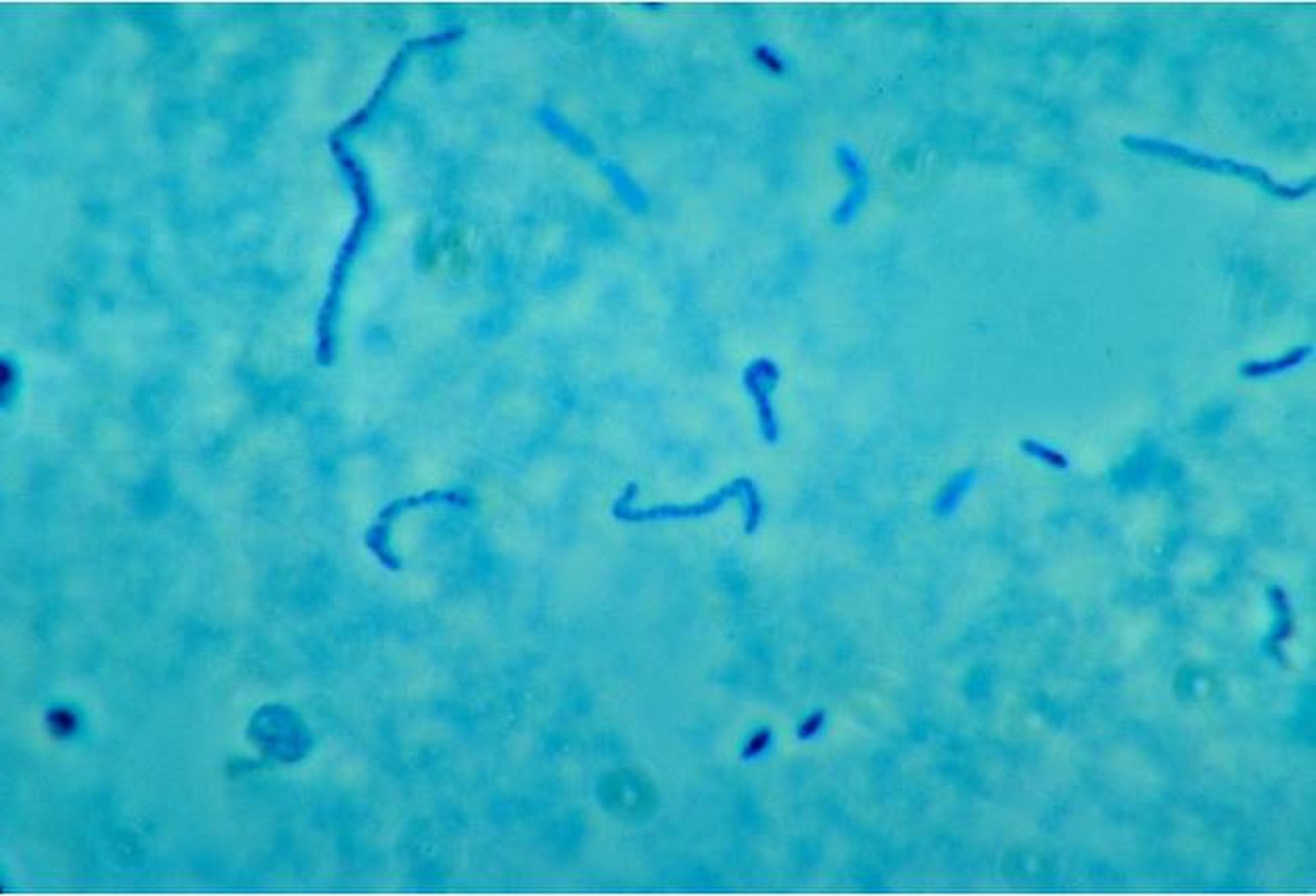 Bactéria Fusobacterium necrophorum, que causa a síndrome de Lemierre (Foto: CDC/ Dr. Lillian V. Holdeman)