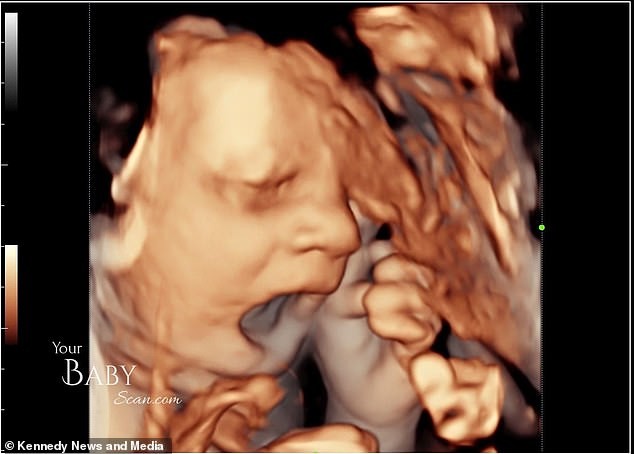 Bebê bocejou antes de mostrar o dedo (Foto: Reprodução/Daily Mail)