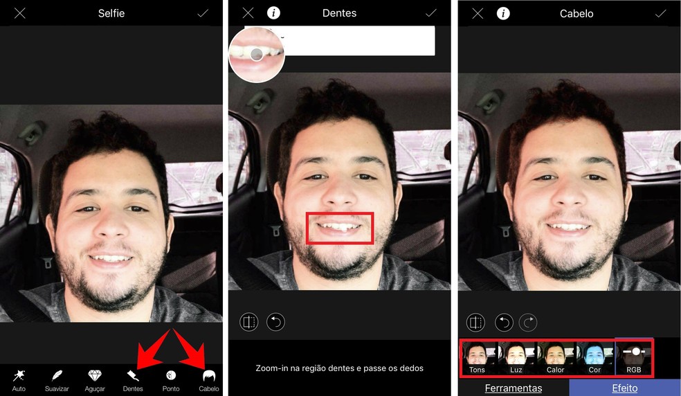 Acentue a cor branca dos dentes e mude a cor do cabelo com o app LightX — Foto: Reprodução/Rodrigo Fernandes