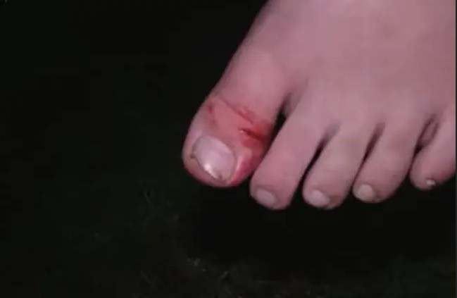 O pé da criança ferido pelo ataque com faca na feira em Ohio (Foto: Reprodução)