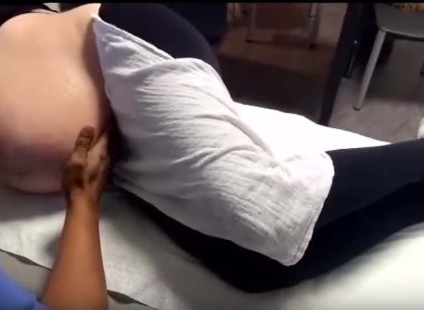 Vídeo mostra manobra cefálica em gravidez de gêmeos (Foto: Reprodução/YouTube)