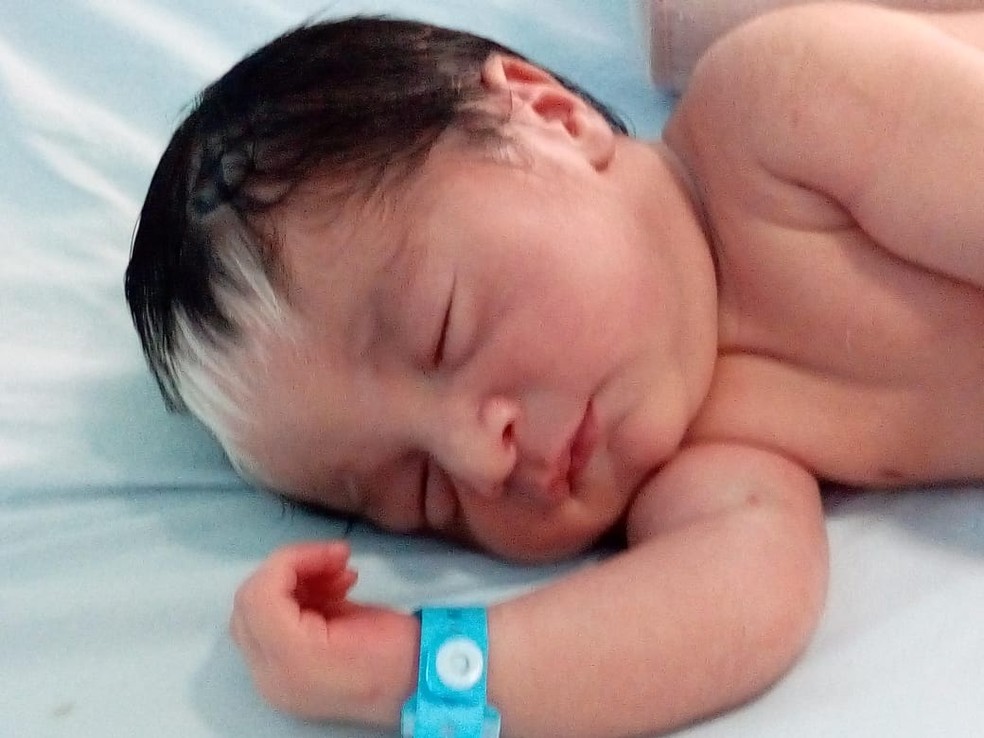 O pequeno João Miguel foi o primeiro bebê que nasceu no hospital de Agudos com a mecha de cabelos brancos — Foto: Arquivo pessoal